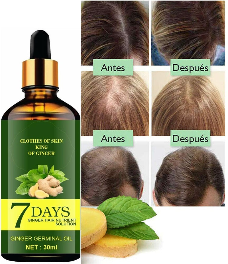 Ginger & Chamomile Hair Oil  ( Pack Of 2 )