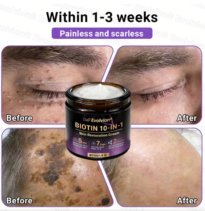 Biotin 10 in 1 Skin Restoration cream(pack of 2)