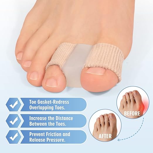 Gel Toe Separators(Pack of 1)