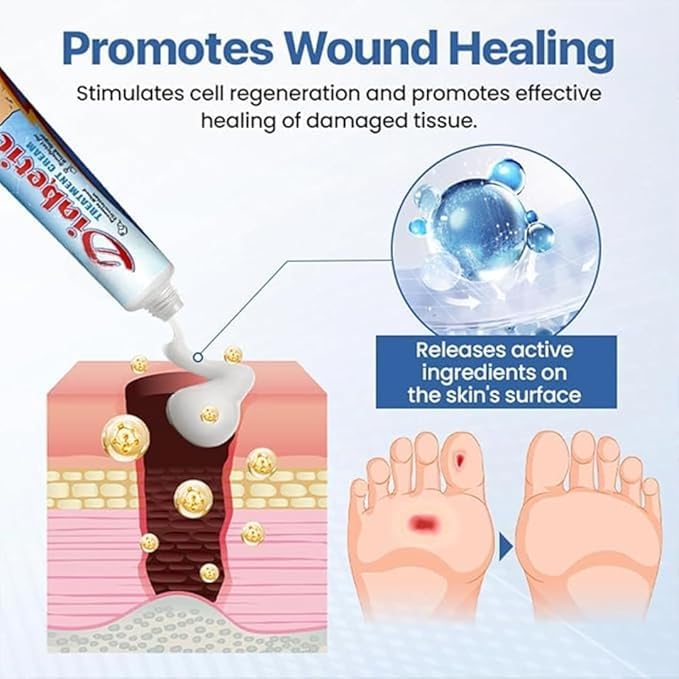 Diabetes Treatment Cream – Diabetic Skin Relief & Foot Care Cream